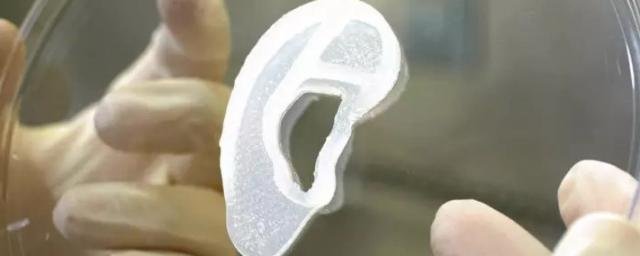 Медики впервые пересадили пациенту ухо, которое напечатали на 3D-принтере