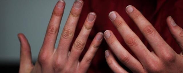 Терапевт Хухрев: Холодные руки могут быть симптомом ревматического заболевания