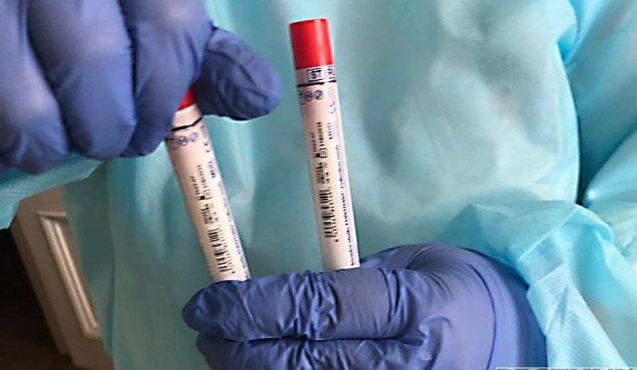 В России выявили более 6 тыс случаев коронавируса