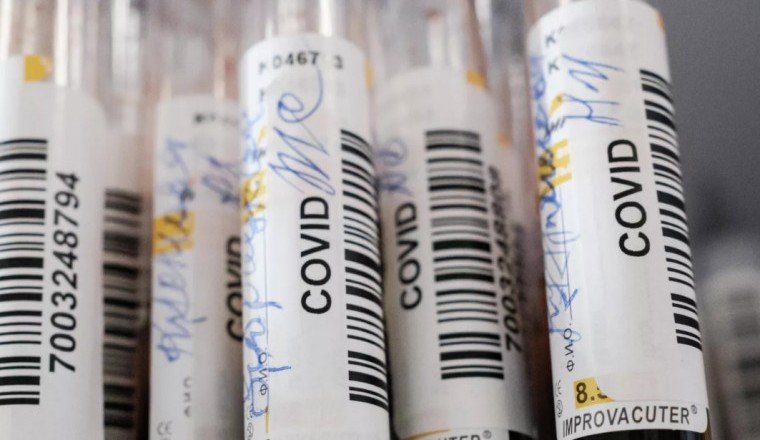 В России зарегистрирован тест на выявление  у болевших бессимптомно иммунитета к COVID-19
