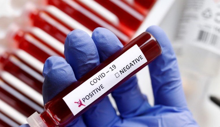 Заболеваемость коронавирусом в России за прошедшую неделю снизилась на 20,4%