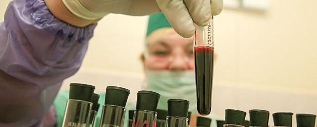Эксперт Минздрава не согласился с данными Роспотребнадзора о 1,5 млн ВИЧ-инфицированных