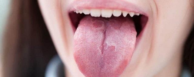 В Британии врачи лечили пациентку с раком языка от стоматологических проблем