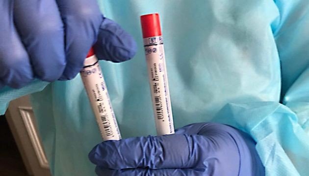 За сутки в РФ выявилено 3 127 новых случаев коронавируса