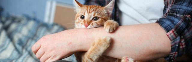 В Калининграде Роспотребнадзор напомнил, какими болезнями можно заразиться от кошек