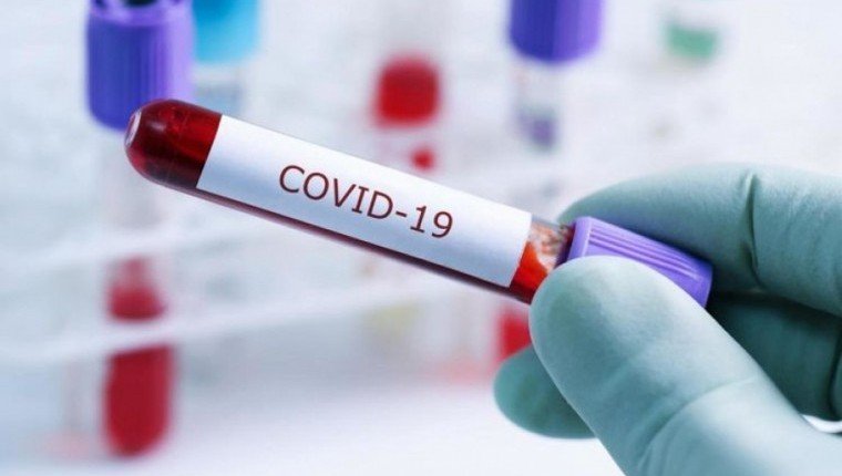 Заболеваемость COVID-19 в РФ за неделю снизилась на 20%