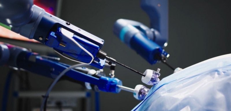 В Санкт-Петербурге впервые операцию на сердце выполнил  робот-хирург