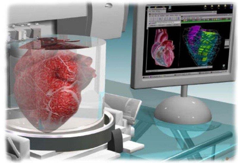 Ученые придумали технологию 3D-печати внутри человеческого тела