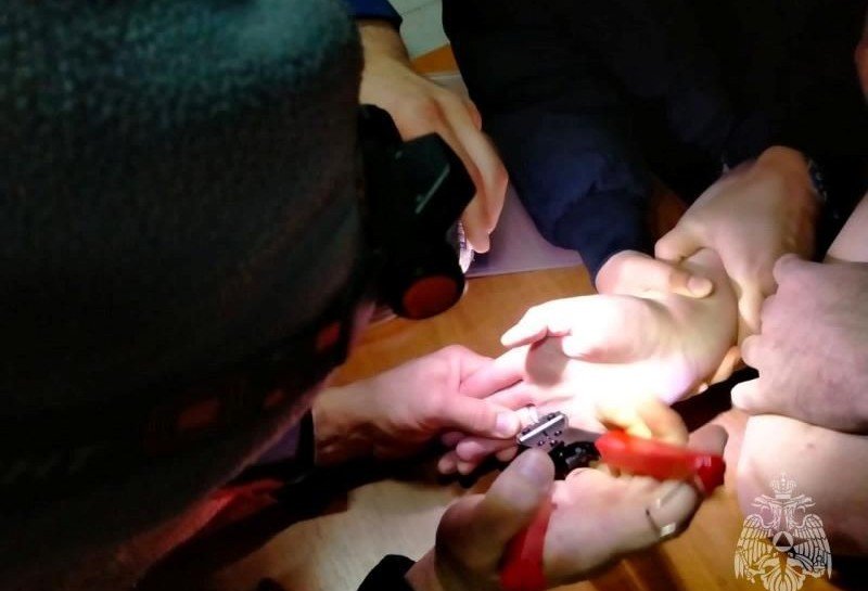 ЧЕЧНЯ.Спасатели МЧС в Грозном сняли кольца с распухших пальцев девочки