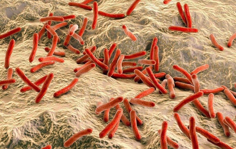 Ученые РФ уничтожили палочки туберкулеза вспышками желтого света и дельта-аминолевулиновой кислотой