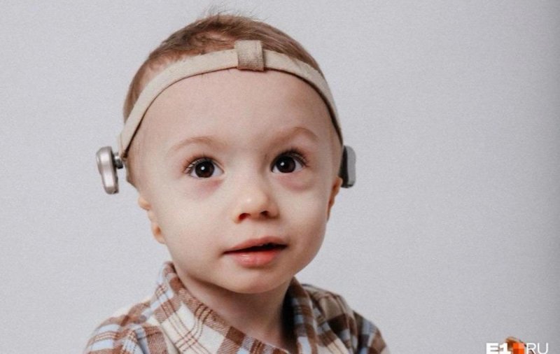 Мальчику, родившемуся без ушей, восстановили слух
