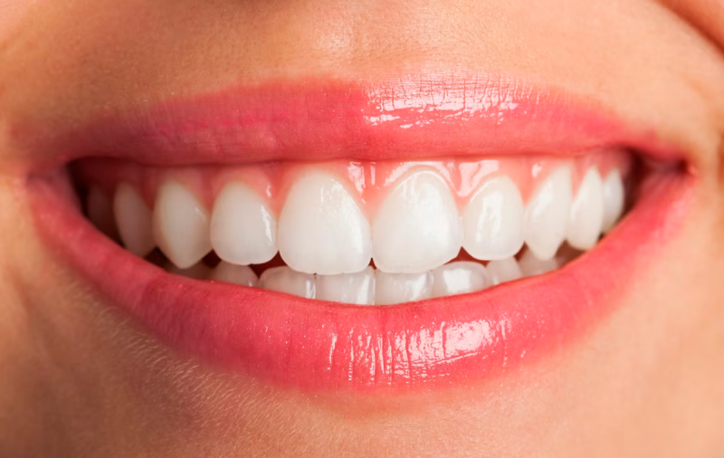 Стоматолог назвала способы добиться «голливудской» улыбки
