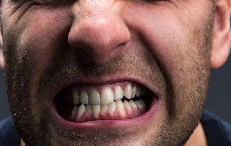 Терапевт Хухрев развеял миф, что скрип зубами связан с наличием паразитов