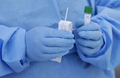 КРАСНОДАР. В Краснодарском крае за неделю выявили 91 случай коронавируса