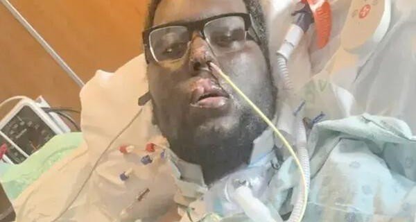 Американец выжил ценой четырех ампутированных рук и ног